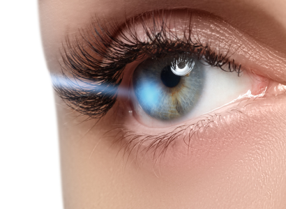 Laser Vision Correction